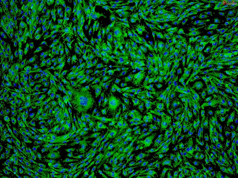 Human Ovarian Microvascular Endothelial Cells, Passage 1