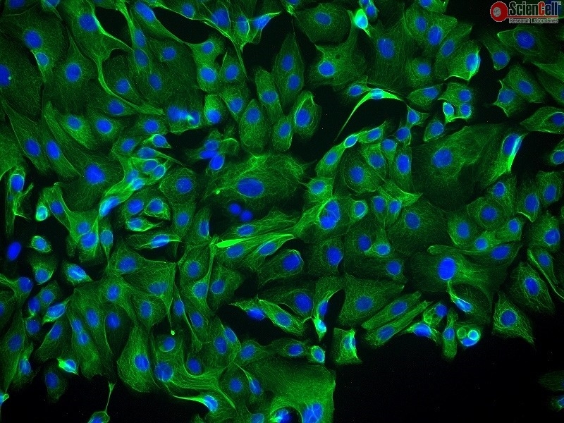 Human Ovarian Surface Epithelial Cells, Passage 1