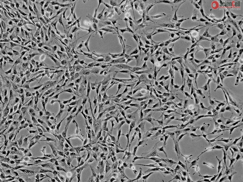 Human Liver-derived Mesenchymal Stem Cells, Passage 1