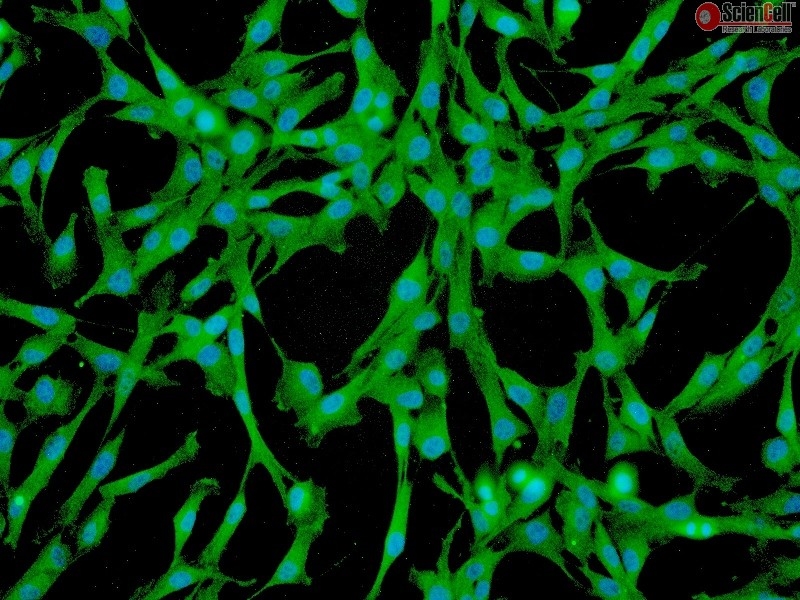 Human Pulmonary Mesenchymal Stem Cells, Passage 1