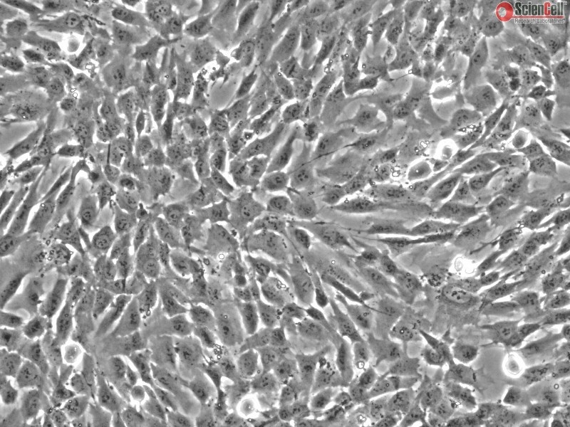 Human Vertebral Mesenchymal Stem Cells, Passage 1