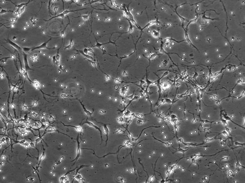 CD1 Mouse Mouse Cerebellar Granule Cells