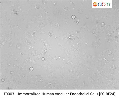 Immortalized Human Vascular Endothelial Cells [EC-RF24]