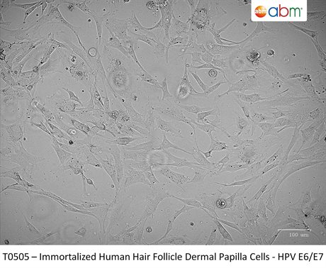 Immortalized Human Hair Follicle Dermal Papilla Cells - HPV E6/E7
