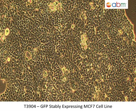GFP Stably Expressing MCF7 Cell Line
