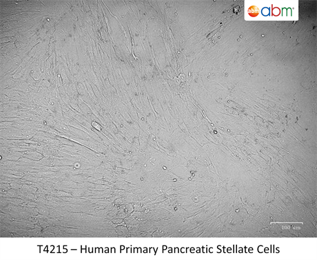 Human Primary Pancreatic Stellate Cells