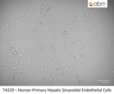 Human Primary Hepatic Sinusoidal Endothelial Cells
