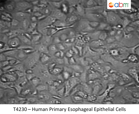 Human Primary Esophageal Epithelial Cells