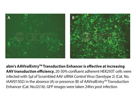 AAViralEntry™ Transduction Enhancer (100X)