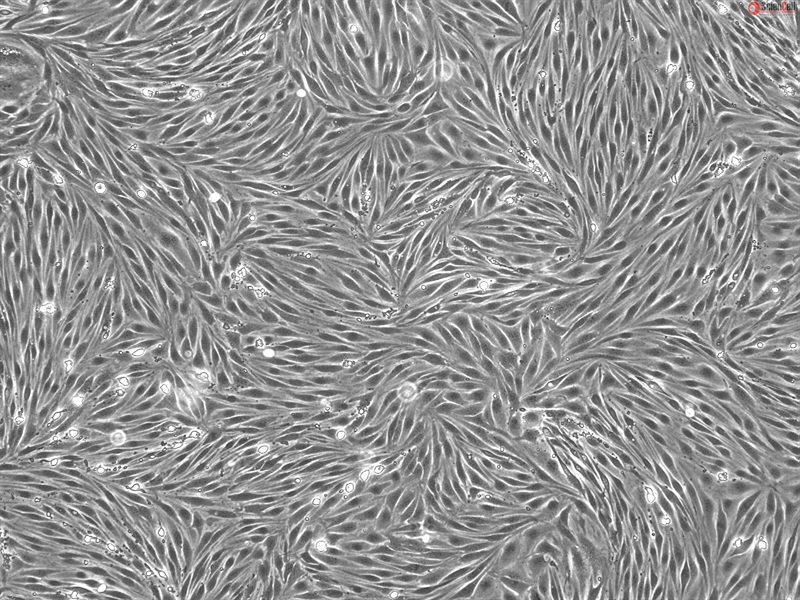 Bovine Brain Microvascular Endothelial Cells, P1