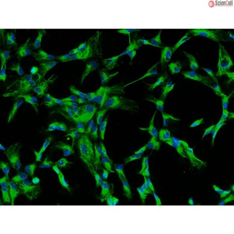 <strong>NEW!</strong> Bovine Lens Epithelial Cells