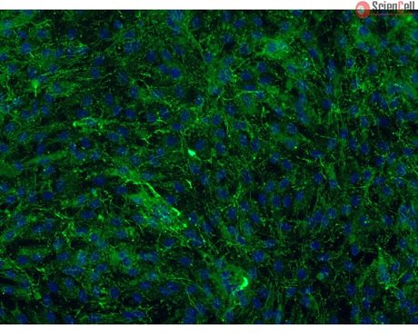 <b>NEW!</b> Bovine Meningeal Cells