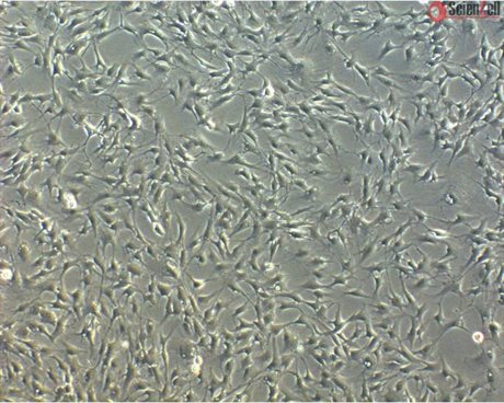 Bovine Meningeal Cells
