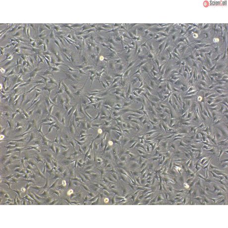 <strong>NEW!</strong> Bovine Oral Fibroblasts