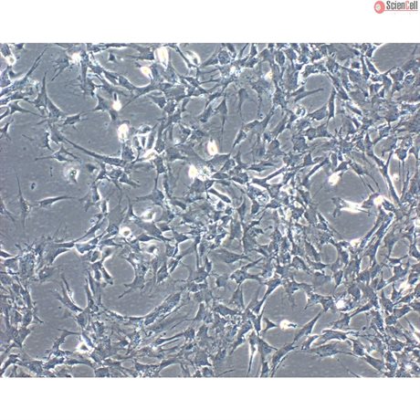 <strong>NEW!</strong> Bovine Retinal Pigment Epithelial Cells