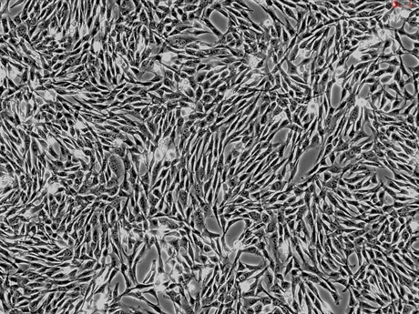 Horse Mesenchymal Stem Cells-adipose