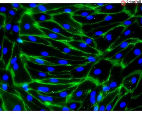 HiPSC-derived Endothelial Cells