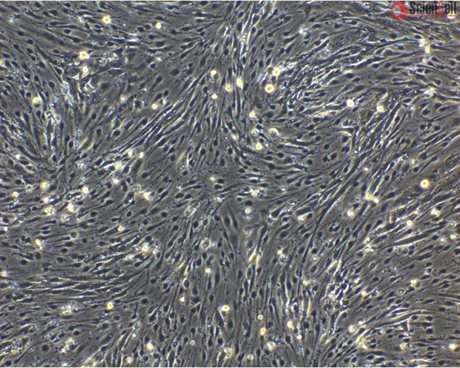 hPSC-derived Endothelial Cells