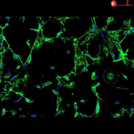 Human Colonic Fibroblasts (CoF)