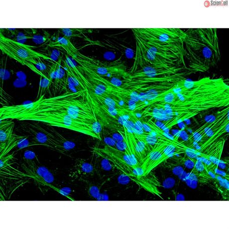Human Coronary Artery Smooth Muscle Cells