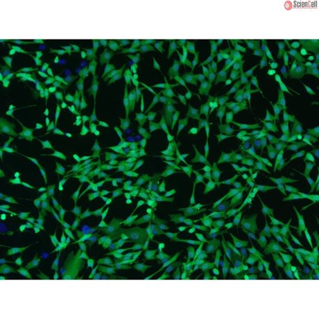 Human Dermal Fibroblasts-GFP