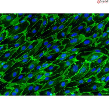 Human Gallbladder Vascular Endothelial Cells