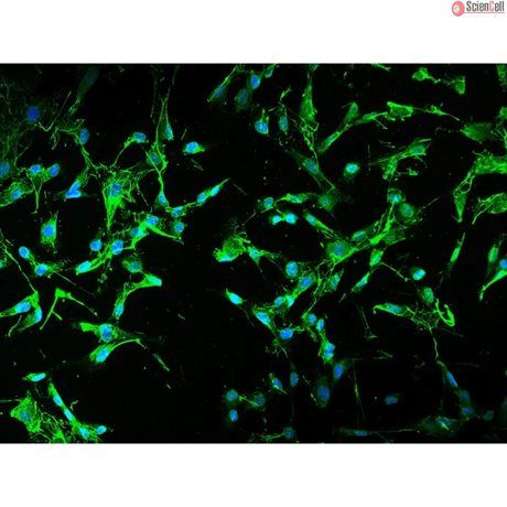 Human Mesenteric Fibroblasts (HMeF) 