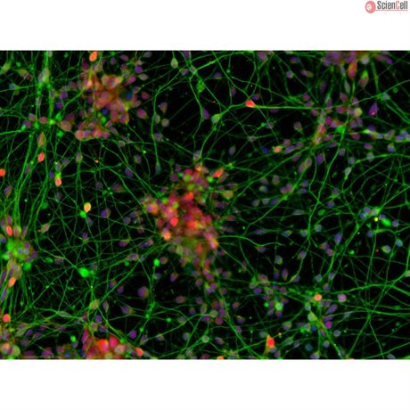 Human Pluripotent Stem Cell Derived-Cortical Neurons