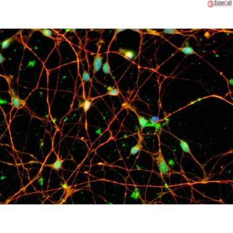 Human Pluripotent Stem Cell Derived-Dopaminergic Neurons