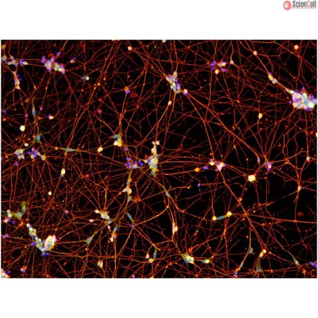 <b>NEW!</b> Human Pluripotent Stem Cell Derived-GABAergic Neurons