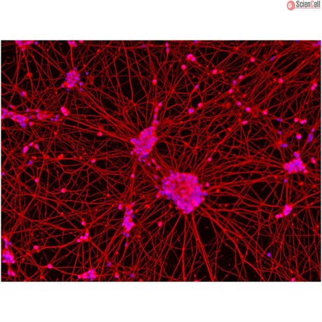 <b>NEW!</b> Human Pluripotent Stem Cell Derived-Motor Neurons