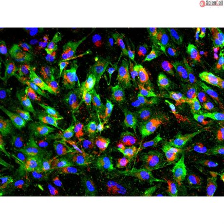 <b>NEW!</b> Human Pluripotent Stem Cell Derived-Pericytes