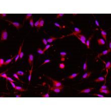 <b>NEW!</b> Human Pluripotent Stem Cell Derived - Schwann Cells