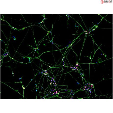 <b>NEW!</b> Human Pluripotent Stem Cell Derived-Sensory Neurons