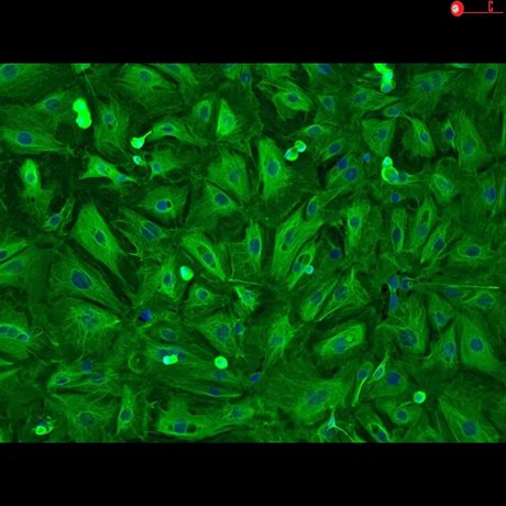 Human Pulmonary Alveolar Epithelial Cells-adult