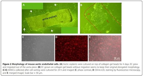 Immortalized Mouse WildType Aortic Endothelial Cells (iMAEC-WT)