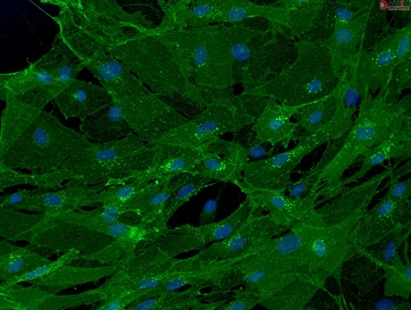 C57BL/6 Mouse Brain Vascular Pericytes (mBVP)