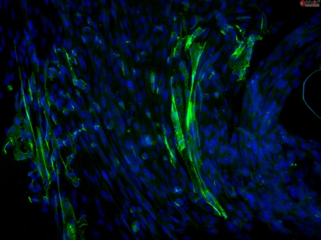 C57BL/6 Mouse Meningeal Cells