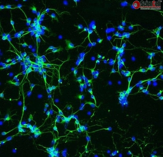Mouse Neurons-substantia nigra