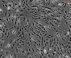 Mouse Perineurial Fibroblasts from C57BL/6