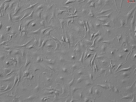 CD1 Mouse Bone Marrow derived Macrophages 