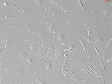 Mouse Lymphatic Fibroblasts from C57BL/6