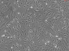 Mouse Pulmonary Fibroblasts from C57BL/6