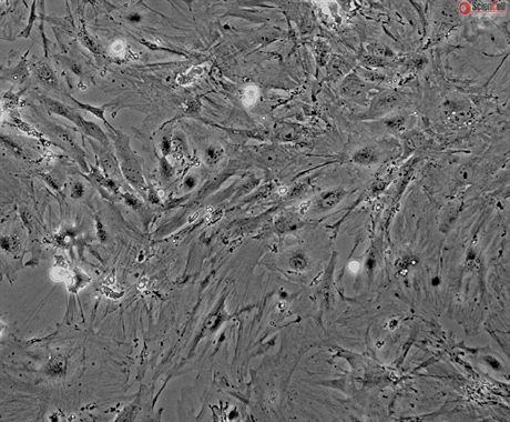 C57BL/6 Mouse Renal Mesangial Cells