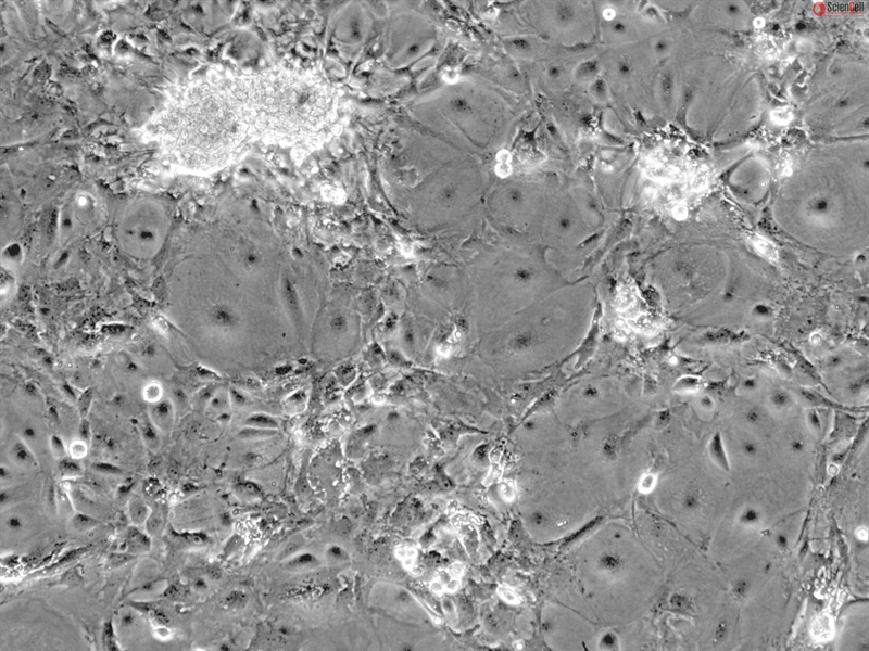 Mouse Cardiac Myocytes from CD1