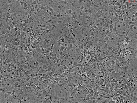 Mouse Cardiac Fibroblasts from C57BL/6