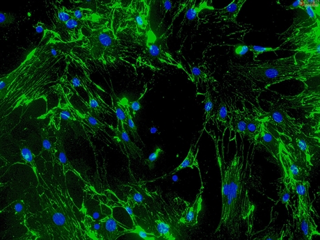 Mouse Cardiac Fibroblasts from CD1