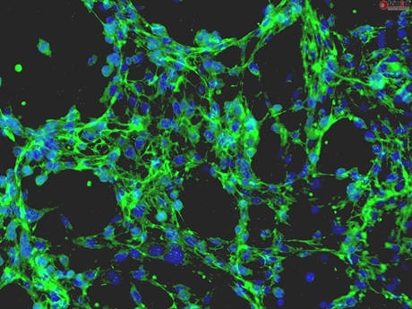 Mouse Embryonic Fibroblasts from CF1