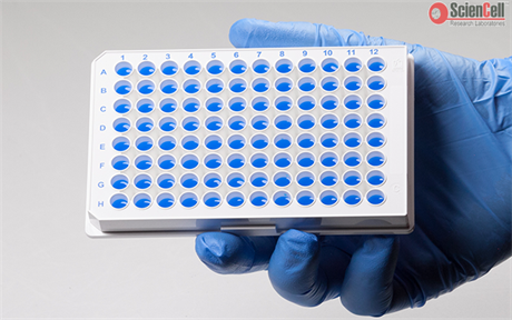 GeneQuery™ Human Mesenchymal to Epithelial Transition qPCR Array Kit