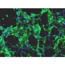 CF1 Mouse Embryonic Fibroblasts-Mitomycin C Treated